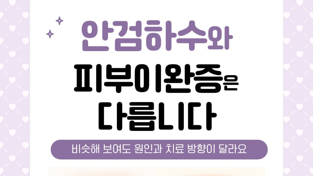눈꺼풀이 처지면 모두 안검하수일까요? 👁️