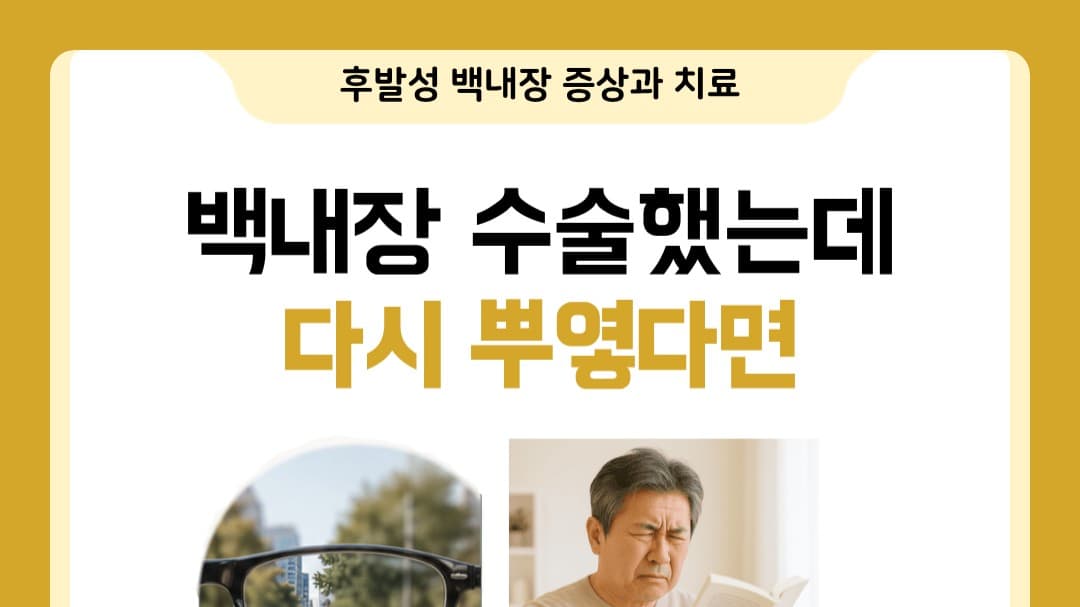👁️ 백내장 수술했는데 다시 뿌옇게 보인다면? 후발성백내장에 대해