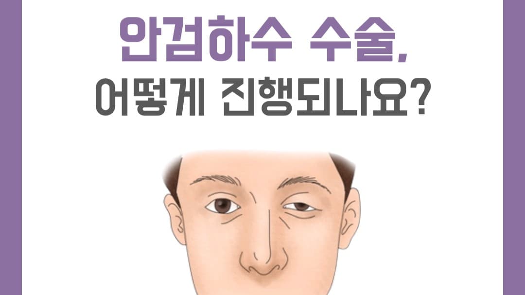안검하수 수술, 누구나 같은 방법으로 할까요? 👀